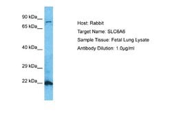 TauT/SLC6A6 Rabbit anti-Human, Polyclonal, Novus Biologicals 0.1ml; Unconjugated:Antibodies,